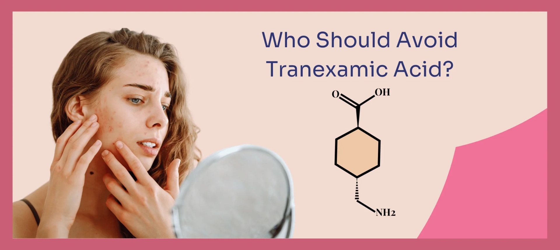 网红“氨甲环酸”被批准用于色斑治疗了吗？